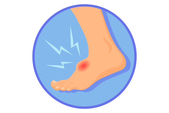 Foot Hurt Medical Illustration Graphics